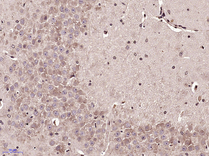 14 - MCP3 Rabbit pAb AP93990