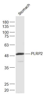 1 - PLRP2 Rabbit pAb AP93991