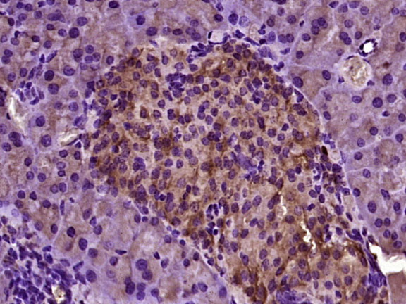 14 - PLRP2 Rabbit pAb AP93991