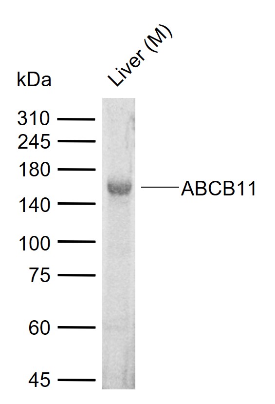 1 - ABCB11 Rabbit pAb AP93992