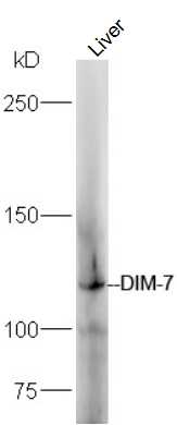 1 - DIM-7 Rabbit pAb AP93993