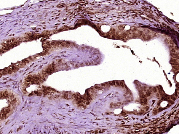 14 - FOXL2 Rabbit pAb AP93995