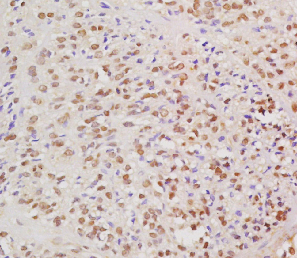 14 - HPV16 E6 Rabbit pAb AP93997