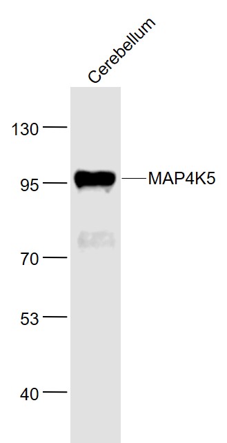 1 - MAP4K5 Rabbit pAb AP93998