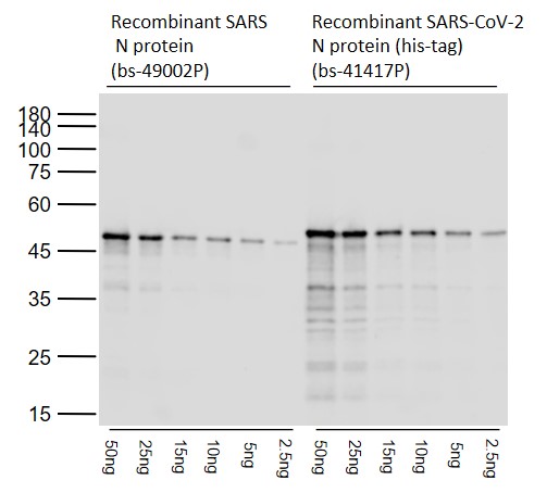 1 - SARS-CoV-2 N Rabbit pAb AP94000