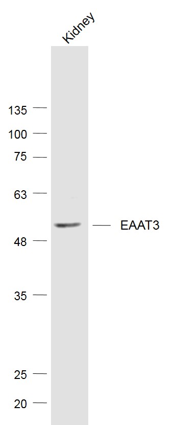 1 - EAAT3 Rabbit pAb AP94001