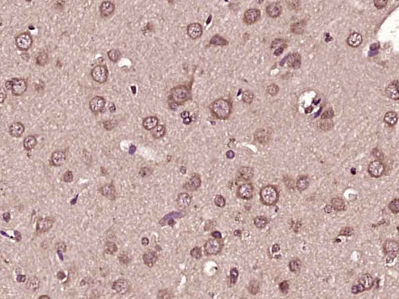 14 - FITM2 Rabbit pAb AP94007