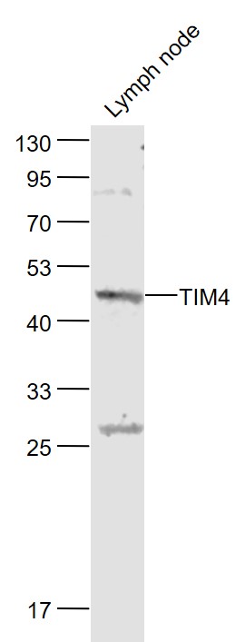 1 - TIM4 Rabbit pAb AP94008