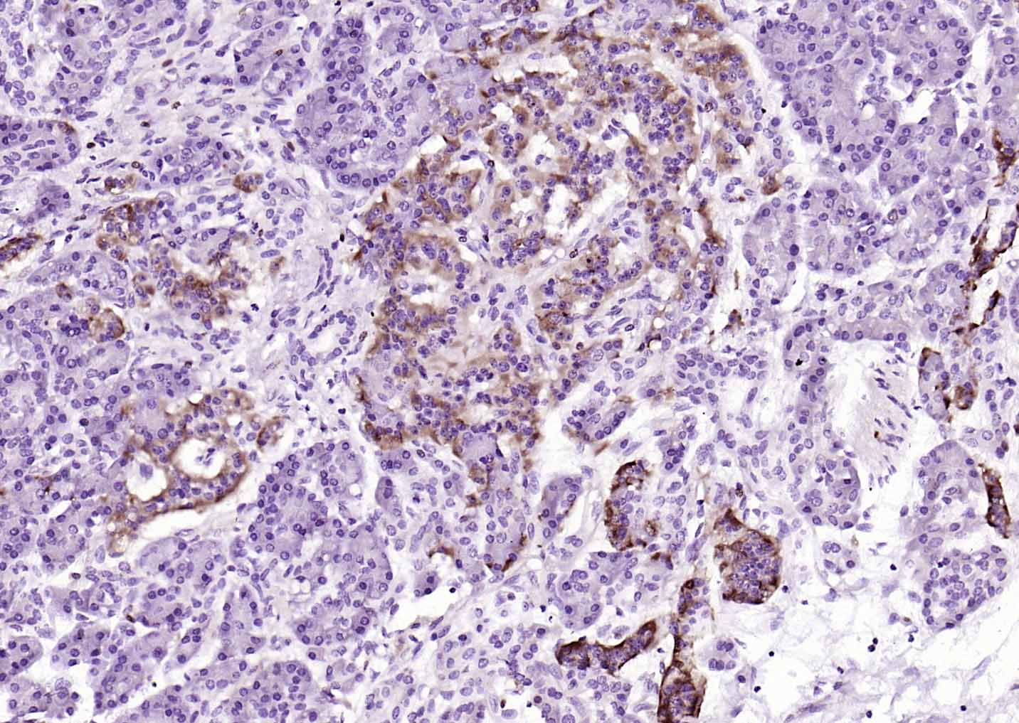 14 - Neuropilin-1 Recombinant Rabbit mAb AP94009