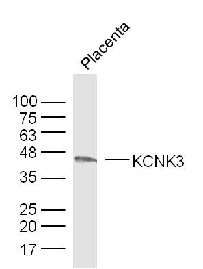 1 - KCNK3 Rabbit pAb AP94011