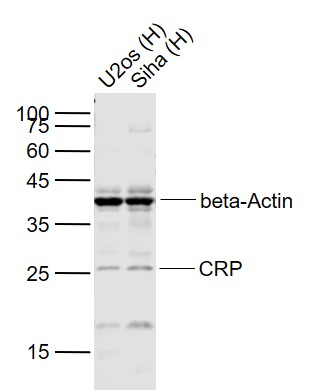 1 - CRP(C11F2) Mouse mAb AP94012