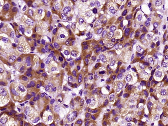 14 - CRP(C11F2) Mouse mAb AP94012