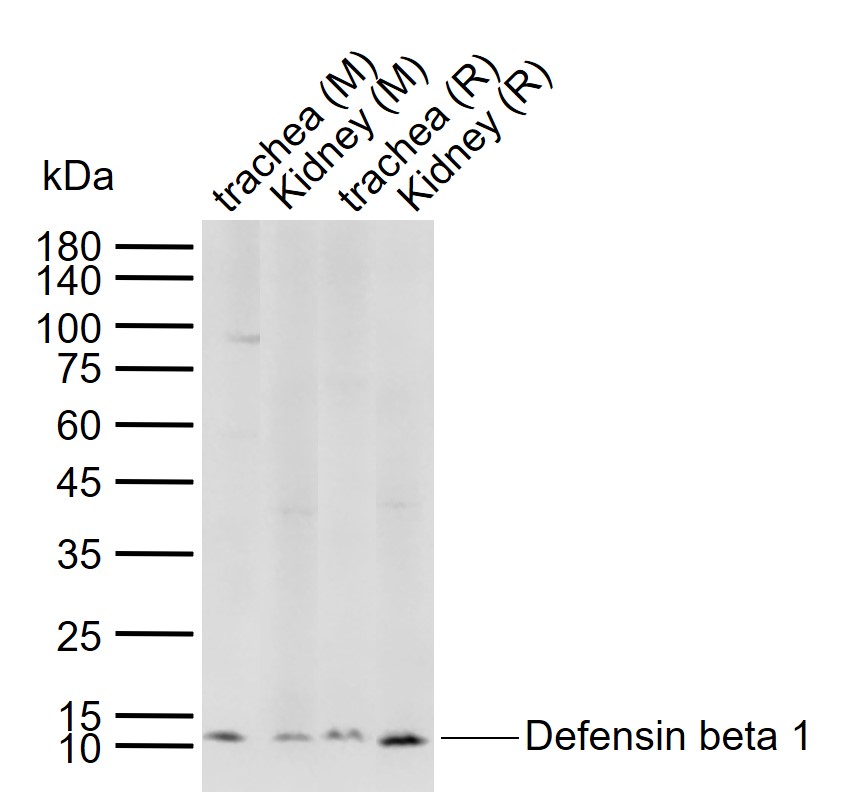 1 - Defensin beta 1 Rabbit pAb AP94013