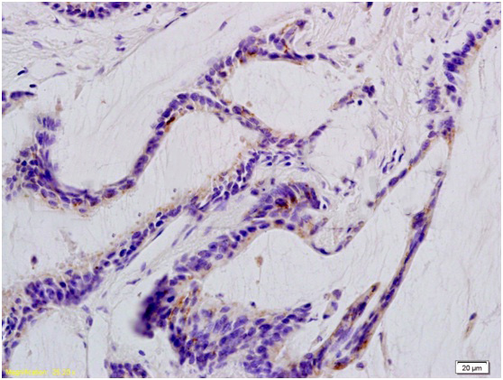 14 - Defensin beta 1 Rabbit pAb AP94013