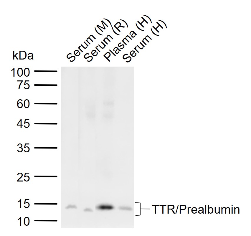 1 - TTR/Prealbumin Rabbit pAb AP94014