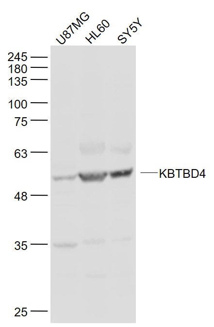 1 - KBTBD4 Rabbit pAb AP94015