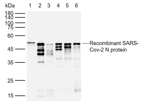 1 - SARS-CoV-2 (2019-nCoV) Nucleocapsid Mouse mAb AP94016