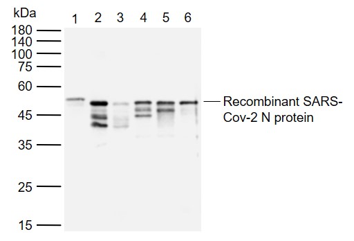 1 - SARS-CoV-2 (2019-nCoV) Nucleocapsid Mouse mAb AP94022