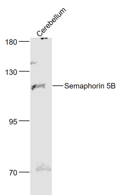 1 - Semaphorin 5B Rabbit pAb AP94023