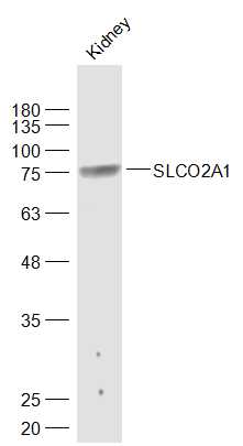 1 - SLCO2A1 Rabbit pAb AP94031