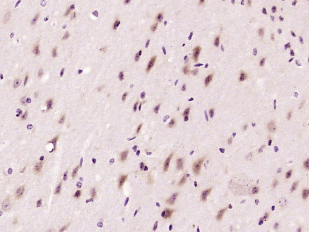 14 - AKD1 Rabbit pAb AP94032