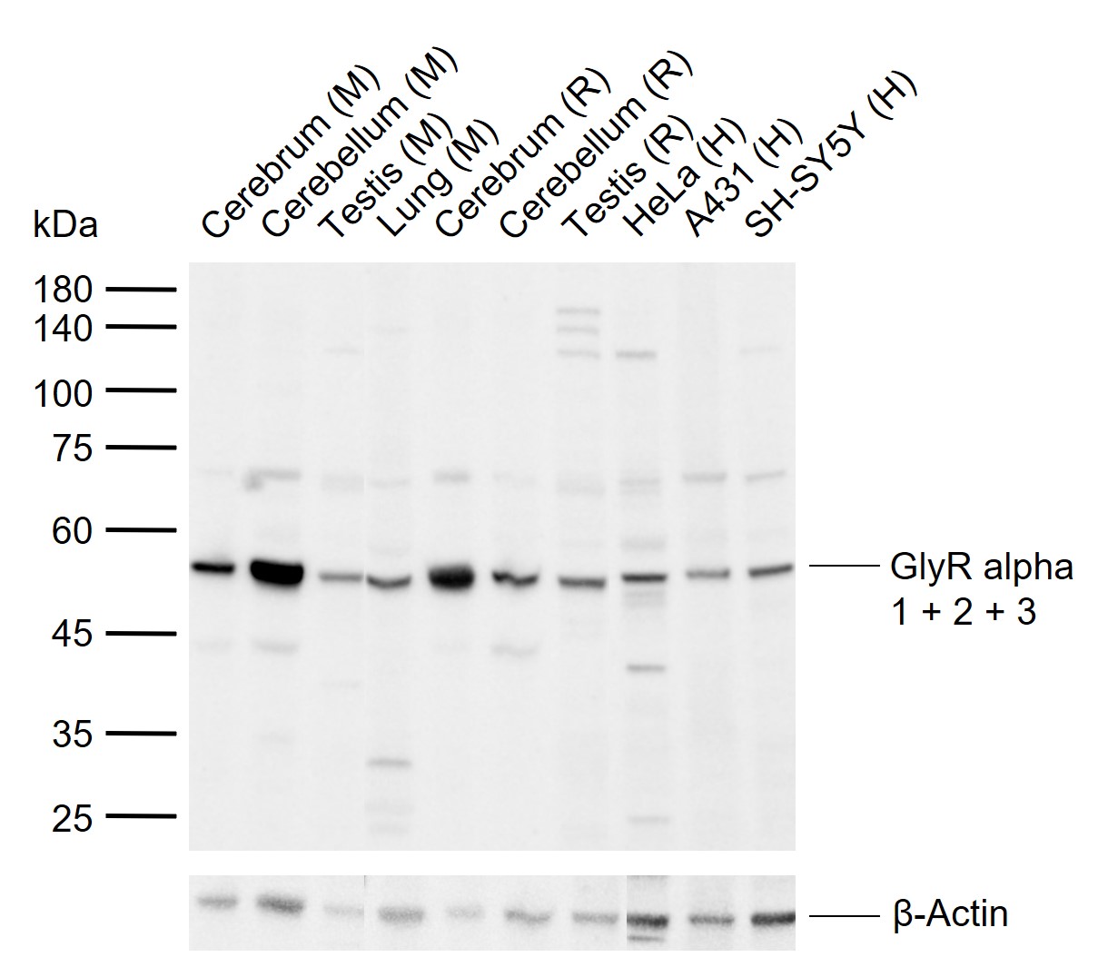 1 - GlyR alpha 1 + 2 + 3 Rabbit pAb AP94037