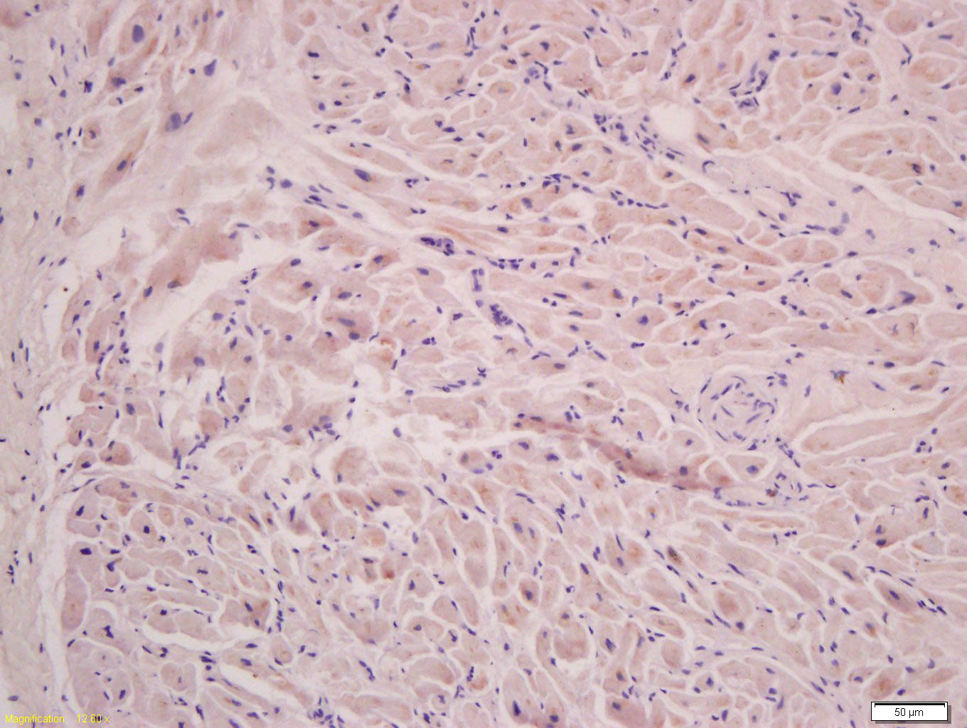 14 - FLNC Rabbit pAb AP94041