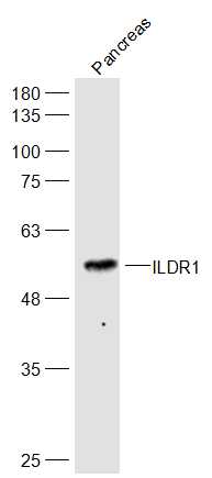 1 - ILDR1 Rabbit pAb AP94042