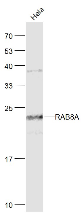 1 - RAB8A Mouse mAb AP94044