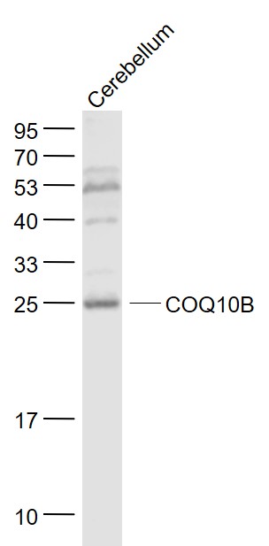 1 - COQ10B Rabbit pAb AP94046