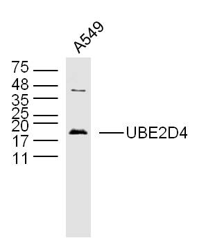 1 - UBE2D4 Rabbit pAb AP94047
