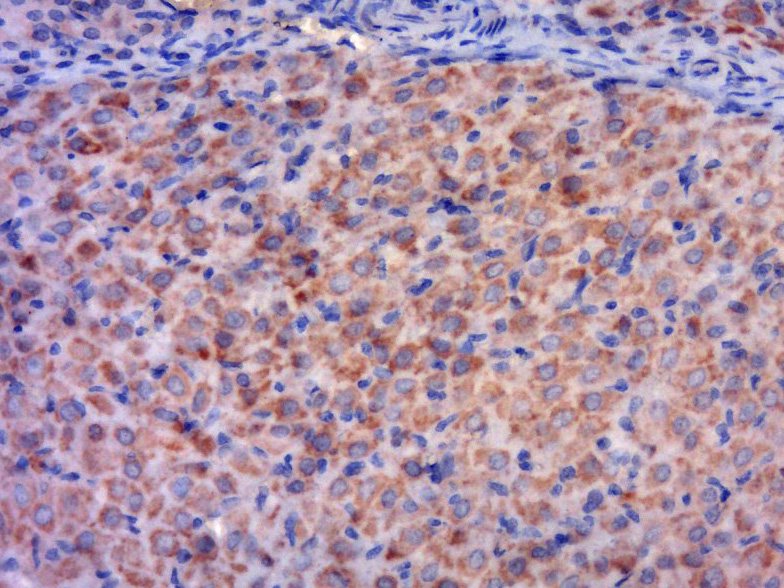 14 - UBE2D4 Rabbit pAb AP94047