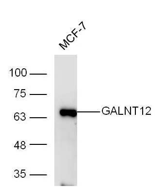 1 - GALNT12 Rabbit pAb AP94051