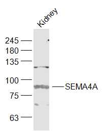 1 - SEMA4A Rabbit pAb AP94053