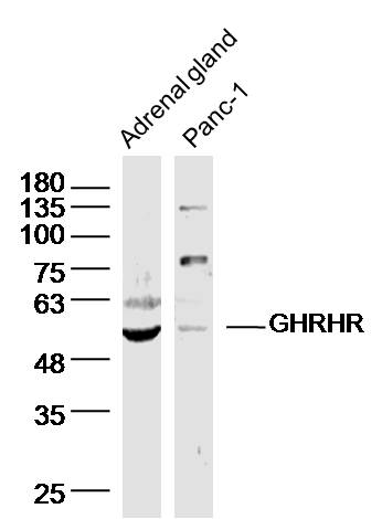1 - GHRHR Rabbit pAb AP94055