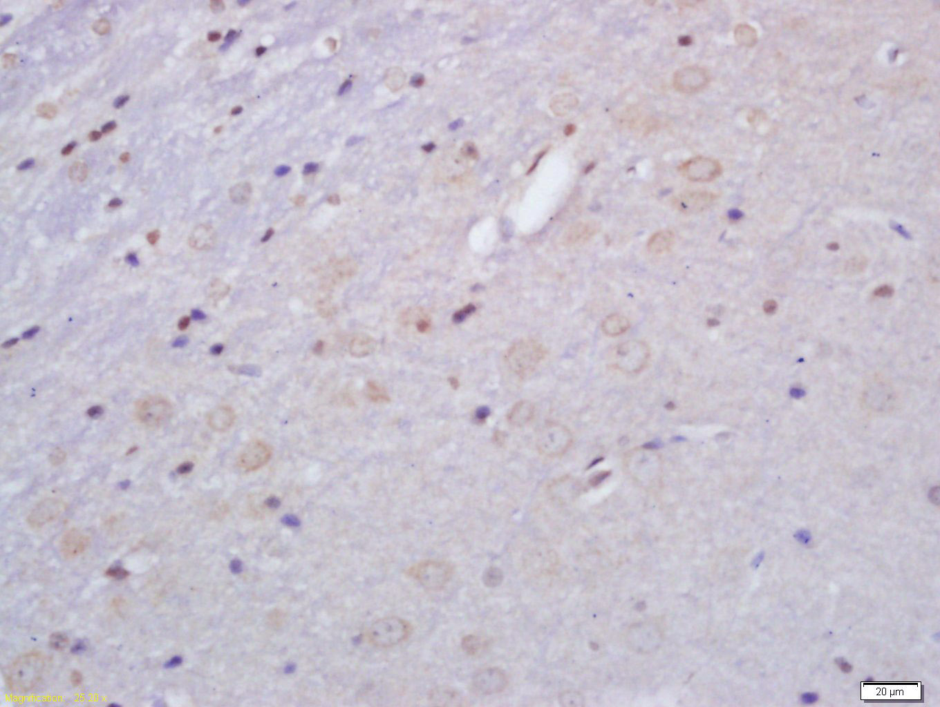 14 - GHRHR Rabbit pAb AP94055