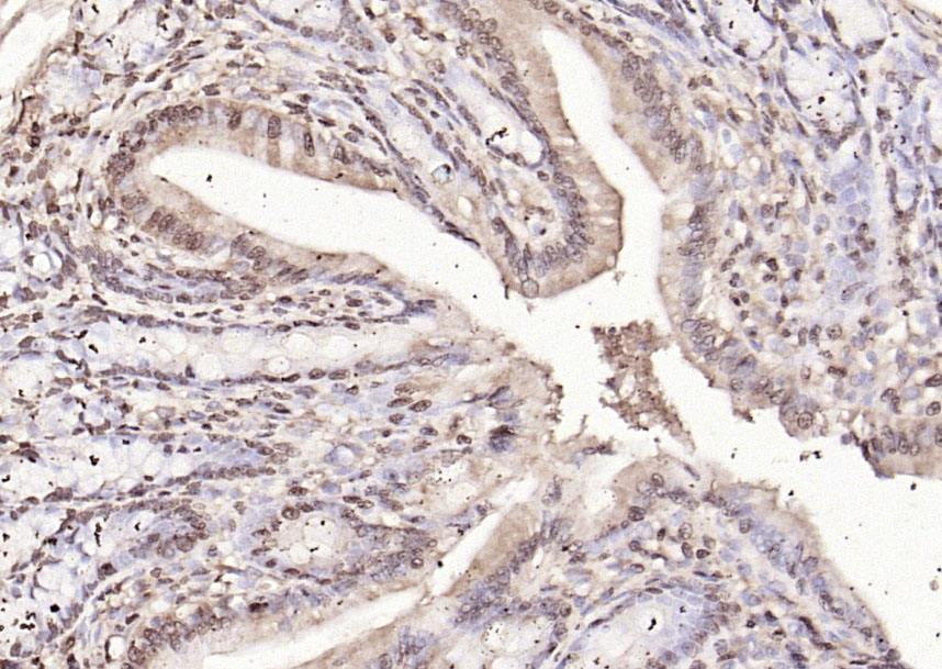 14 - RPS6KA1 Rabbit pAb AP94056