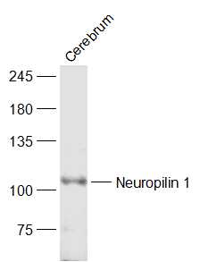 1 - Neuropilin 1 Rabbit pAb AP94058
