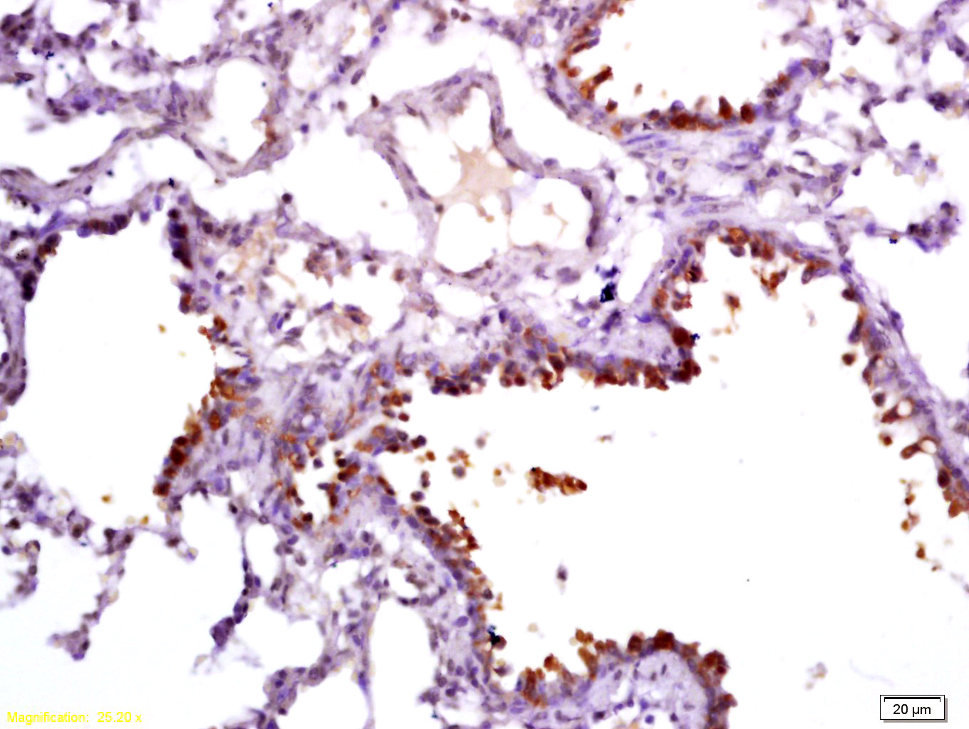 14 - Uteroglobin Rabbit pAb AP94060