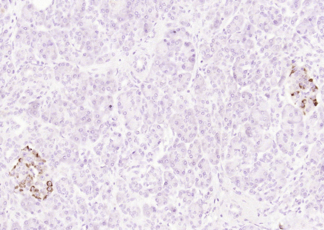 14 - CD151 Rabbit pAb AP94061