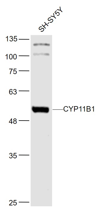 1 - CYP11B1 Rabbit pAb AP94063