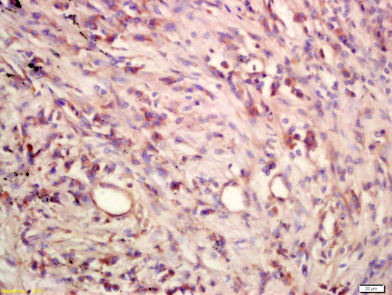 14 - CCL27 Rabbit pAb AP94065