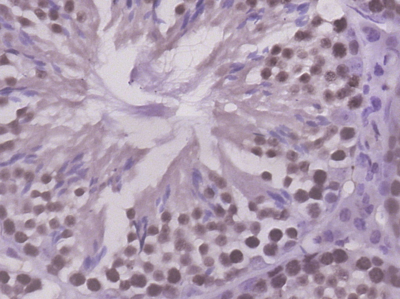 14 - PRC1 Rabbit pAb AP94070
