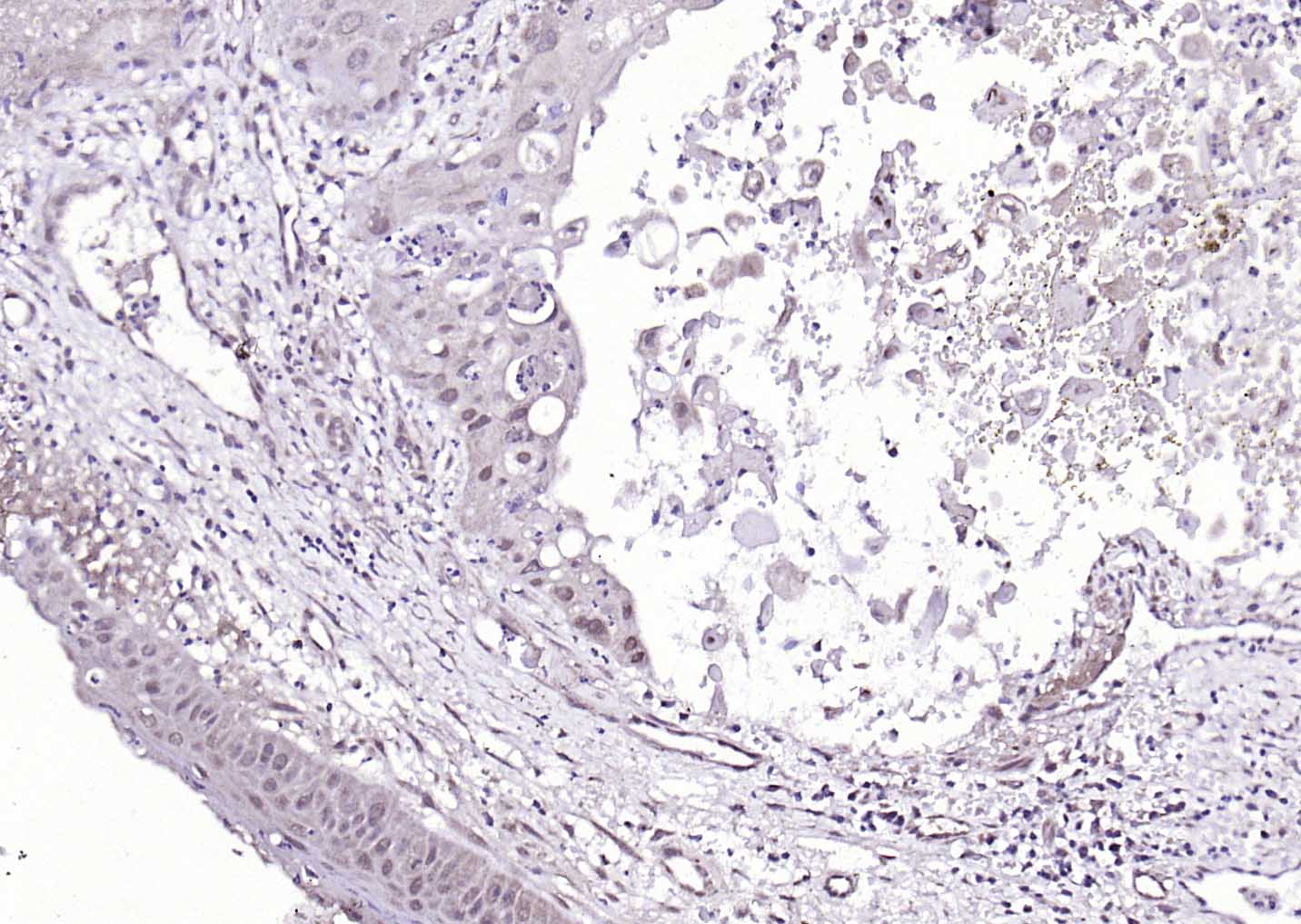 14 - HPV16 E7 Rabbit pAb AP94071