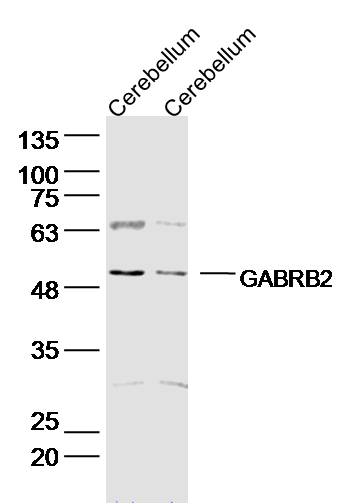 1 - GABRB2 Rabbit pAb AP94072