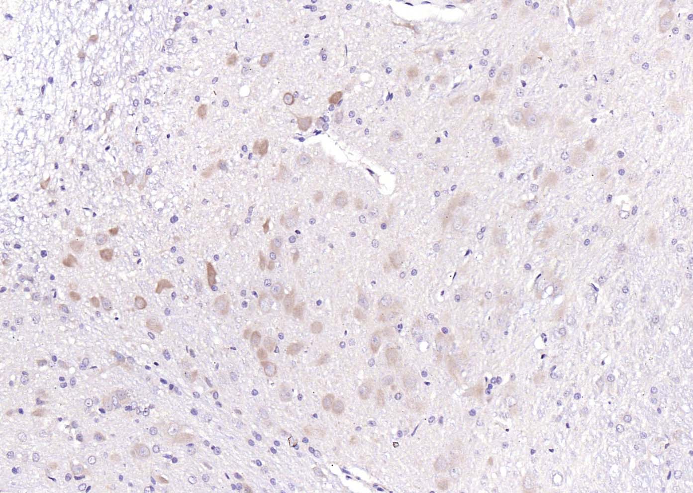 14 - GABRB2 Rabbit pAb AP94072