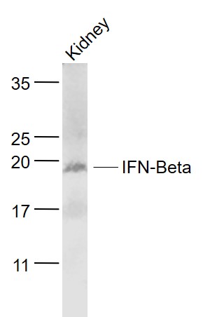 1 - IFNB1 Rabbit pAb AP94073