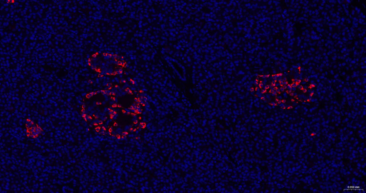3 - Chromogranin B Rabbit pAb AP94074