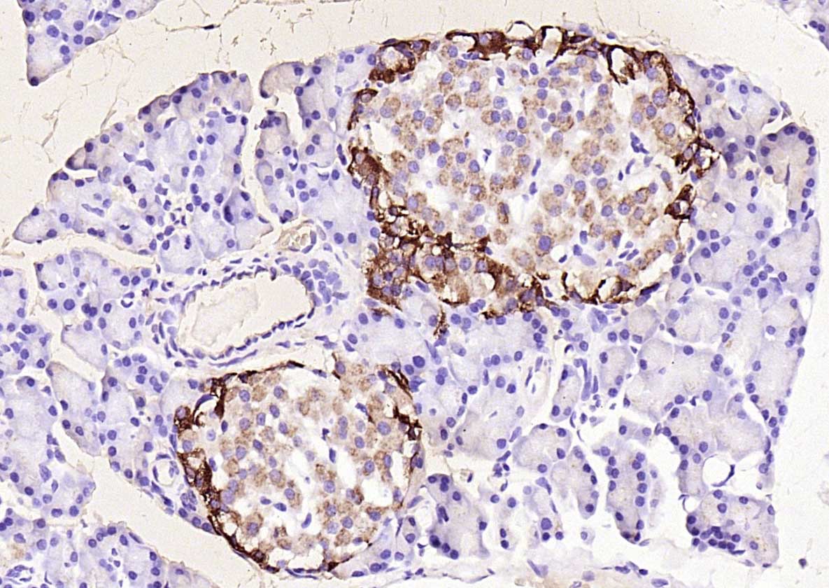 14 - Chromogranin B Rabbit pAb AP94074