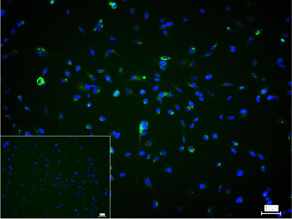 0 - Collagen I Rabbit pAb AP94077